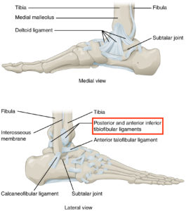 High ankle sprains involve ligaments that attach above the ankle joint, hence the name.