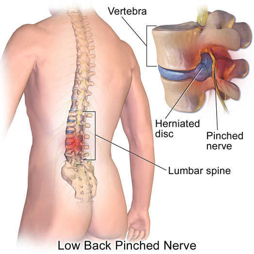 back-pain-cause
